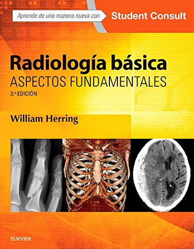 Radiología Básica Y Student Consult - 3ª Edición
