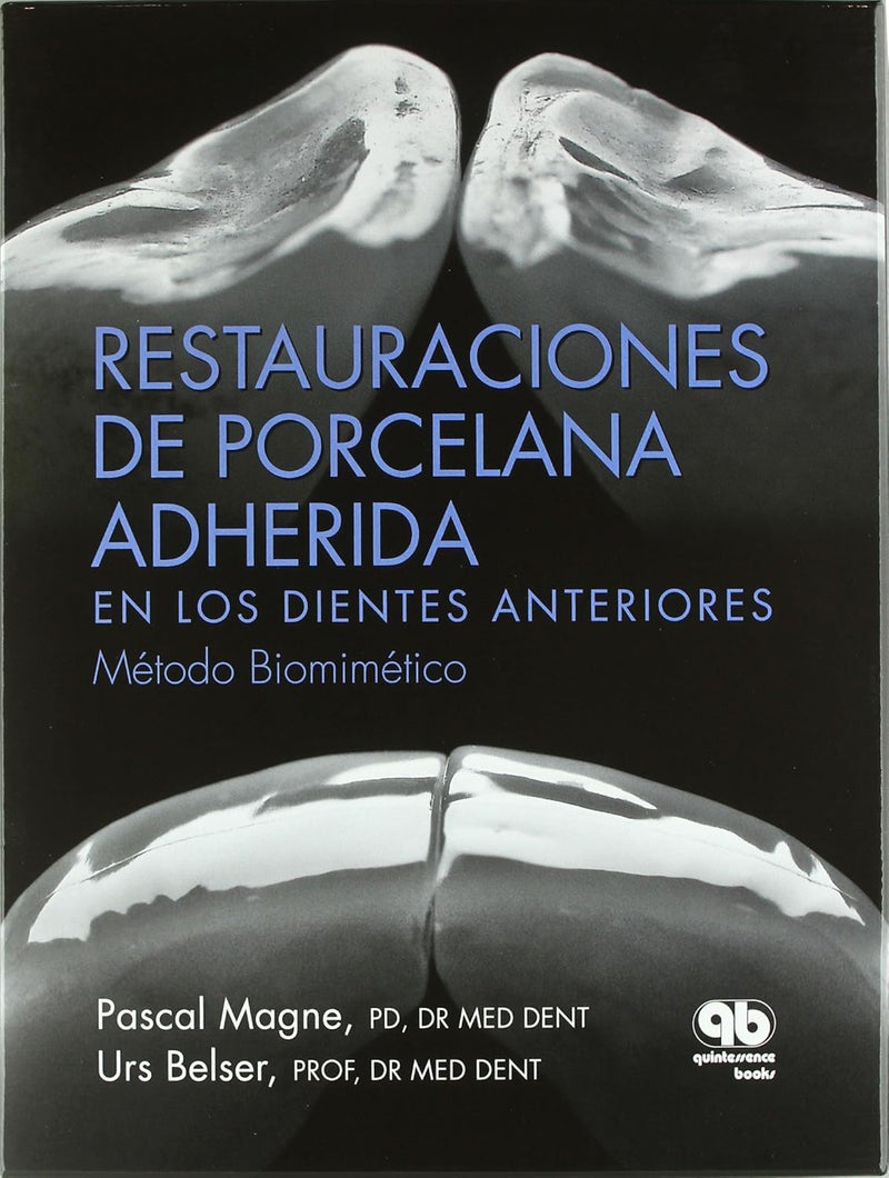 Restauraciones de Porcelana Adherida en los Dientes Anteriores: Un Enfoque Biomimético