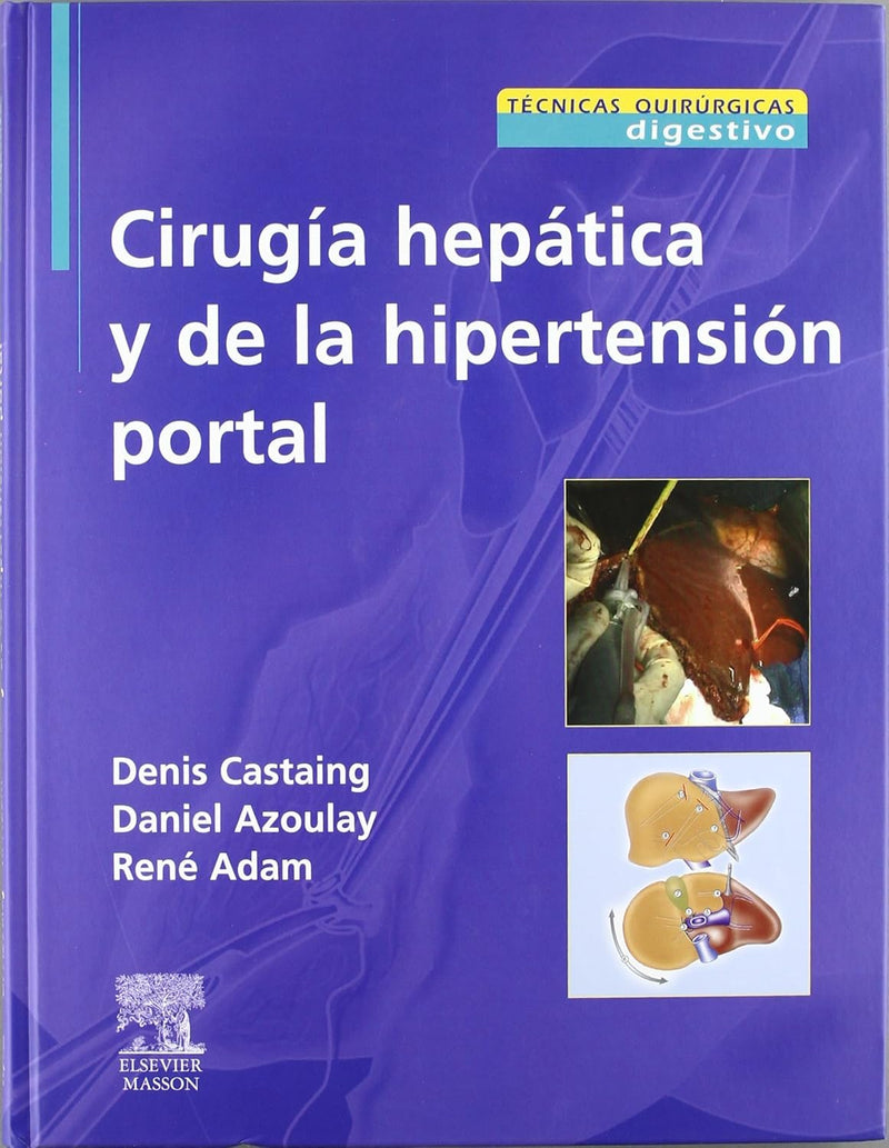 Cirugía hepática y de la hipertensión portal